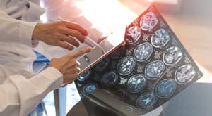 Supervised and Unsupervised Learning Algorithms